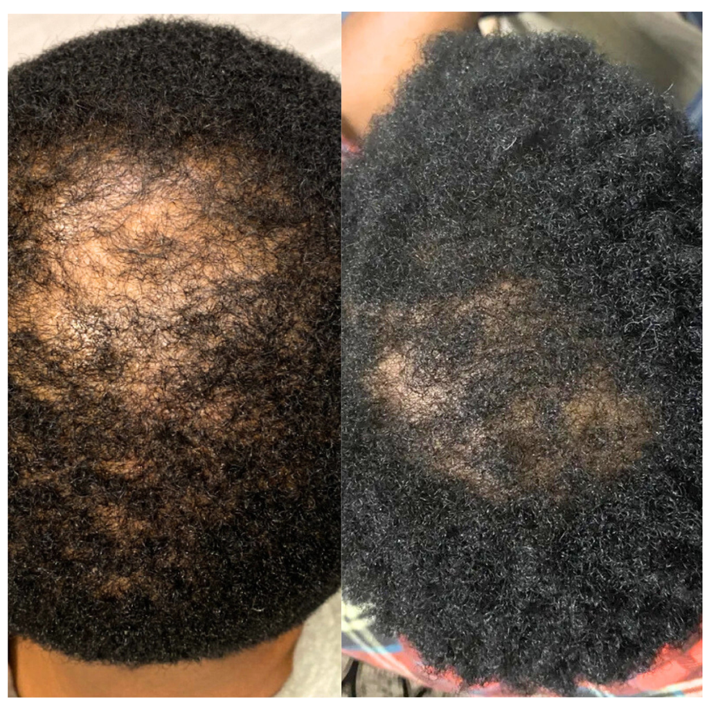 Soothe & Boost Root Activator for All Hair Types | Ayurvedic Herbal Scalp Therapy