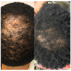 Soothe & Boost Root Activator for All Hair Types | Ayurvedic Herbal Scalp Therapy