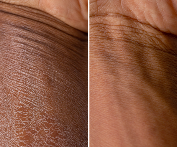 Hydrating Body Butter