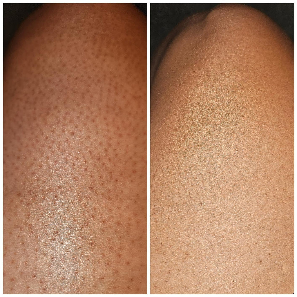 Before and after comparison of skin texture on a person's knee after using JOONIVERSE Herb-Infused Exfoliating Scrub | Penetrative Hybrid Polish
